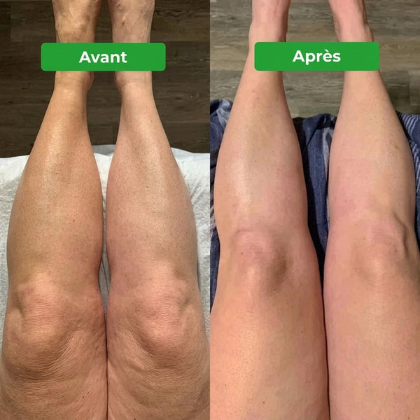 mielora review cuisses